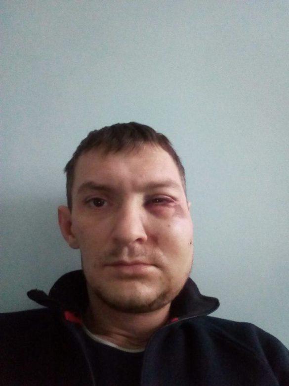 Во время массовой драки солдаты ВСУ избили начальника Ахметова в Мариуполе