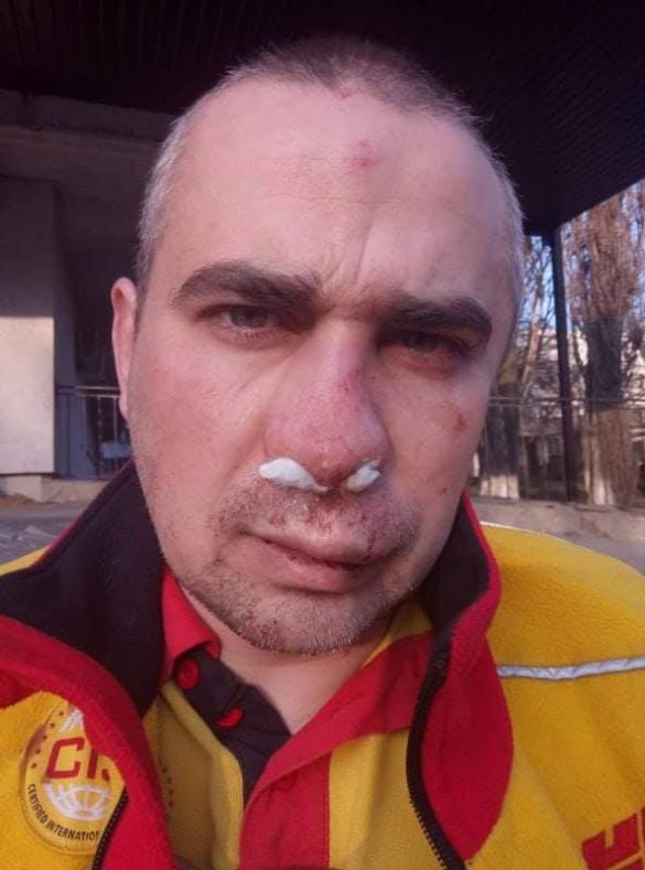 В Одессе охранники жёстко избили ветерана АТО