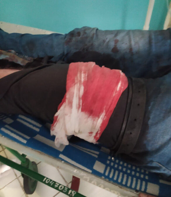 Украинский снайпер ранил гражданина РФ на окраине Донецка